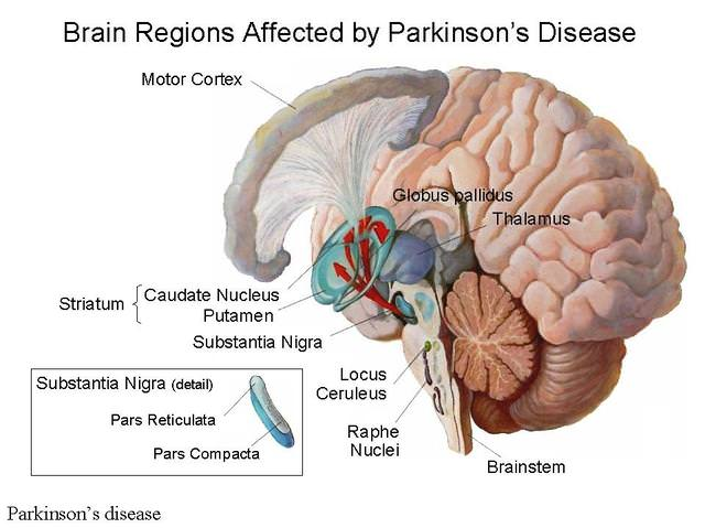 Parkinson’s Disease – Symptoms, causes