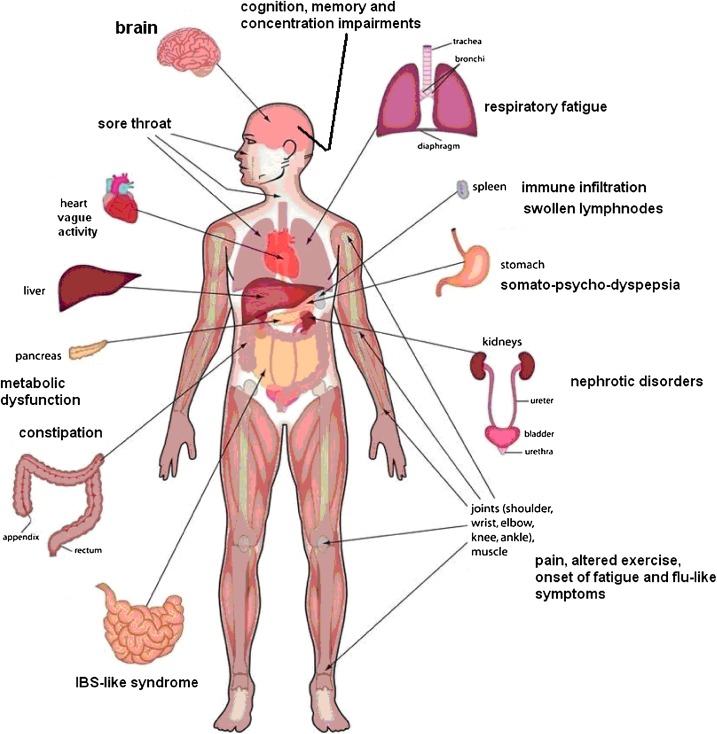 Chronic Fatigue Syndrome (ME/CFS)