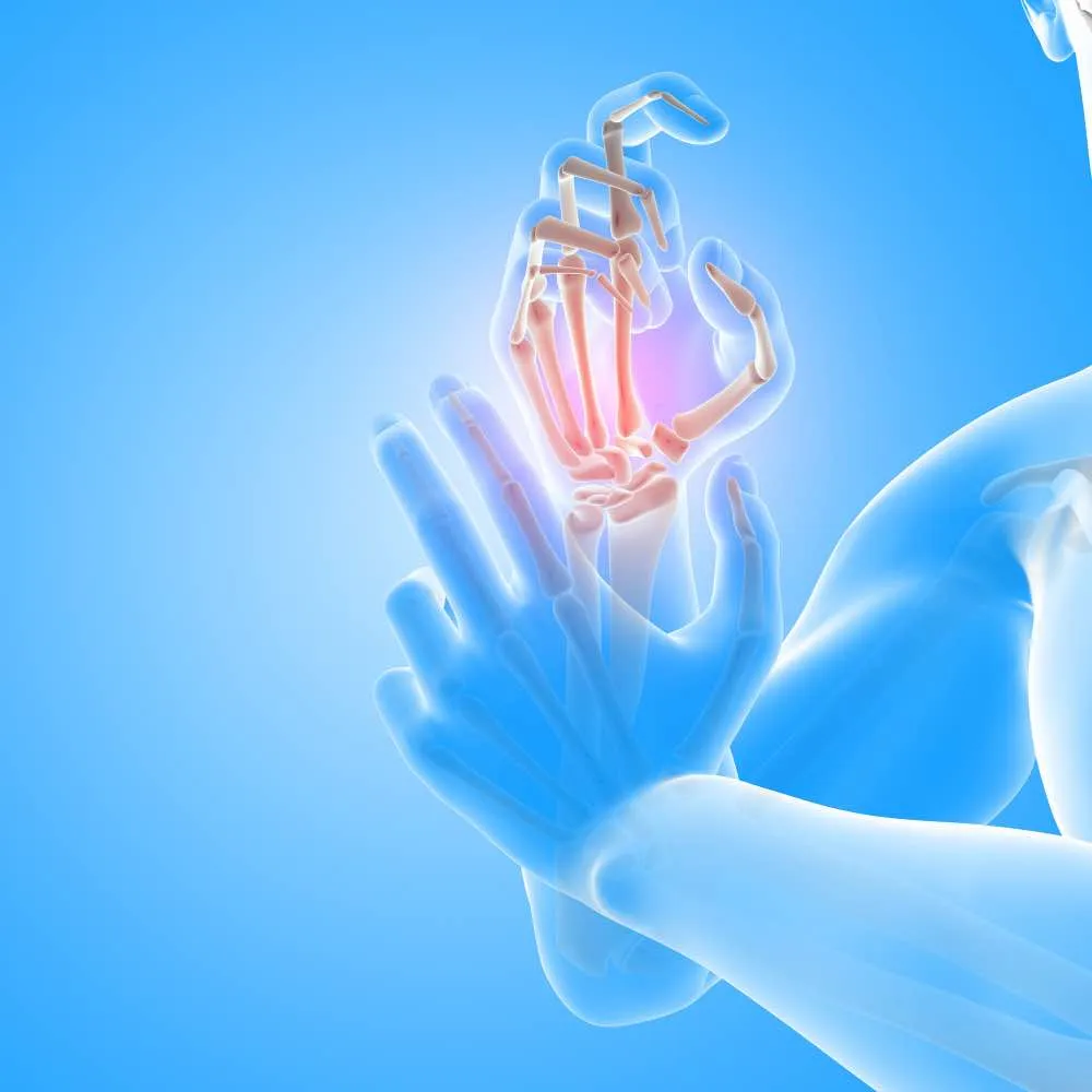 De Quervain’s Syndrome Treatment in Richmond Hill