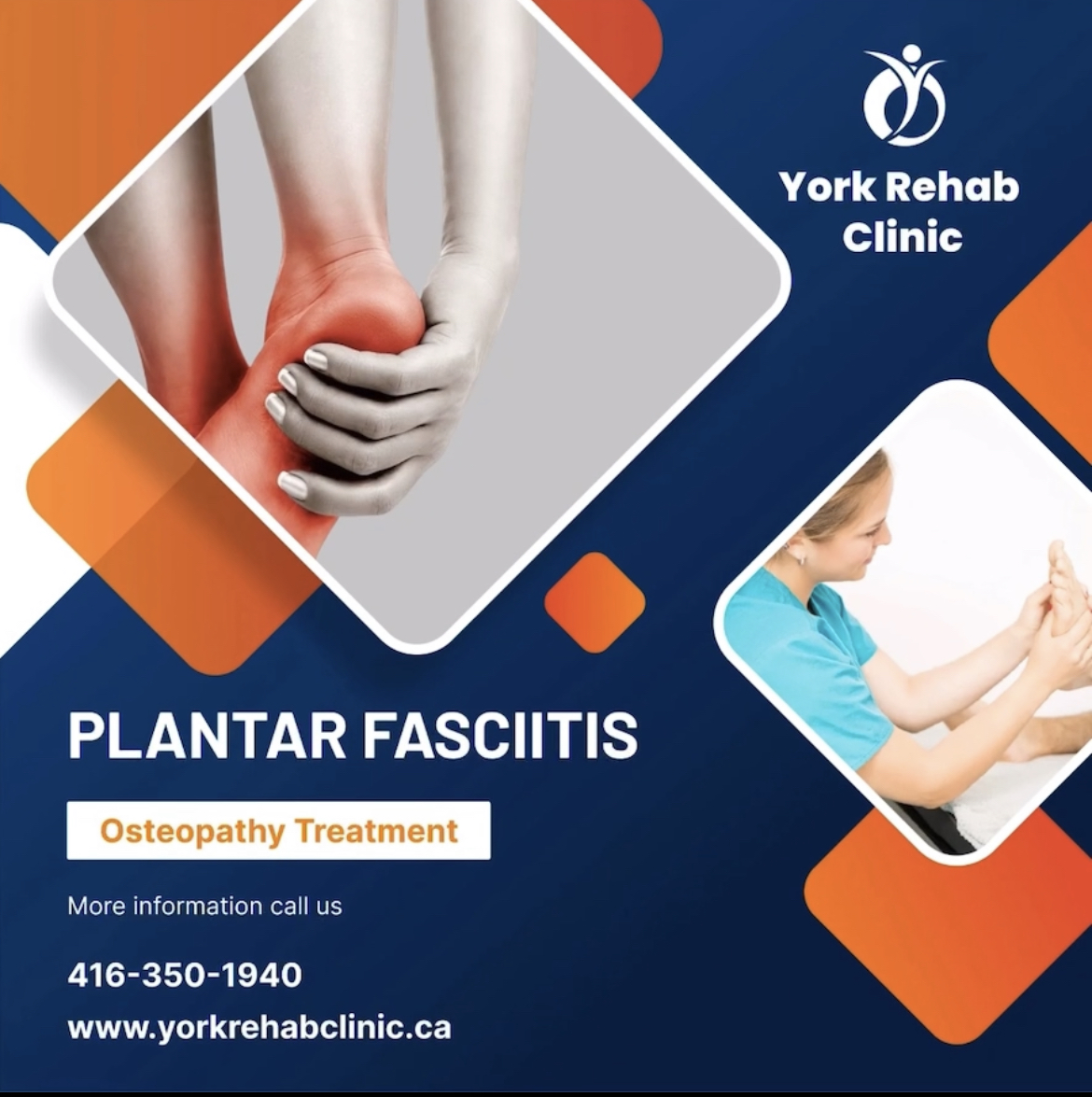 Osteopathy To Treat Plantar Fasciitis