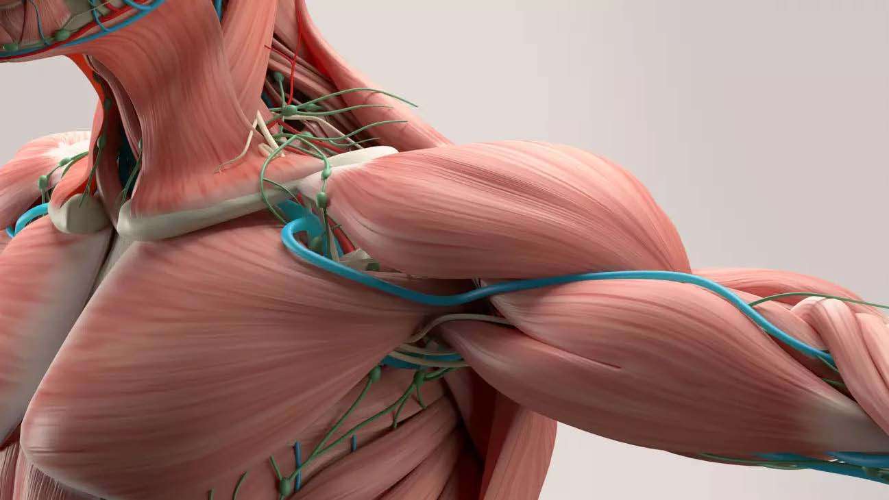 Thoracic outlet syndrome (TOS)