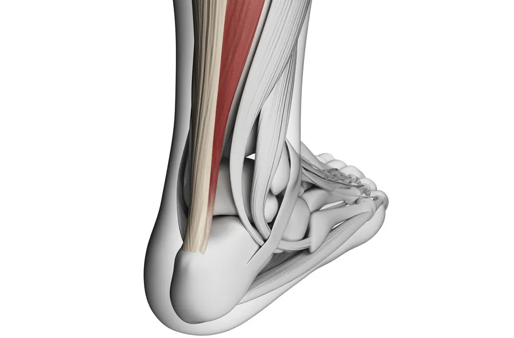 Achilles tendinitis – Symptoms & causes