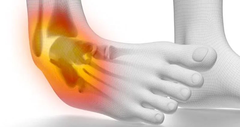 Ankle Injuries in Sports | Treatment