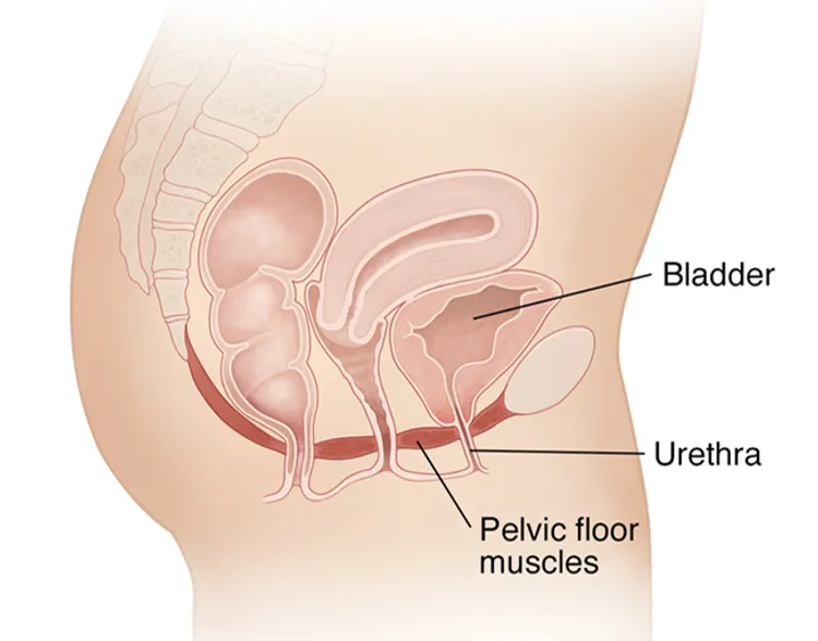 Pelvic Floor physiotherapy