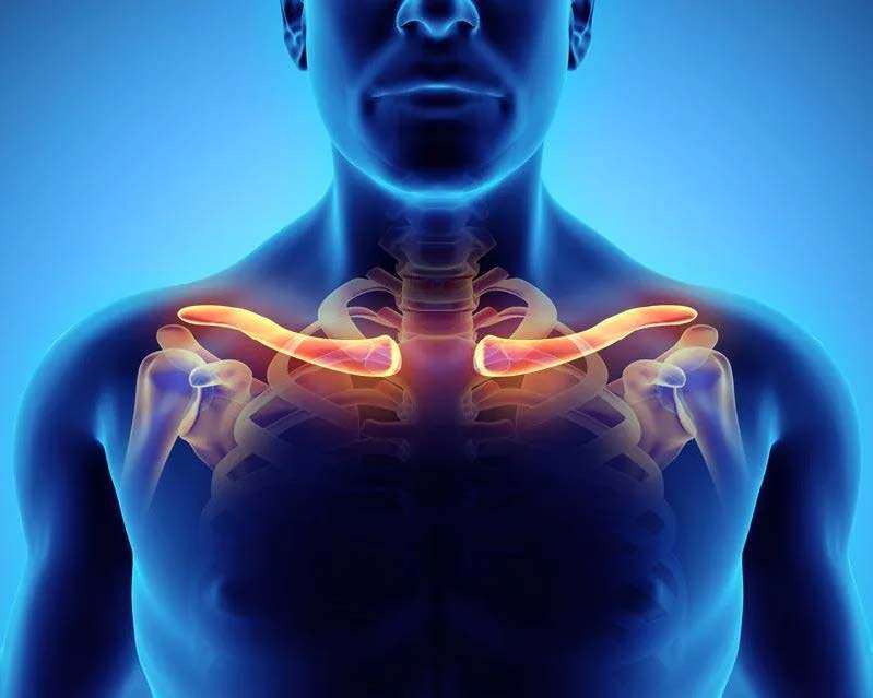 What Is Thoracic Outlet Syndrome Q