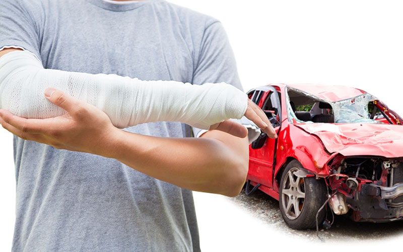 Car Accident Injuries To Arms And Legs