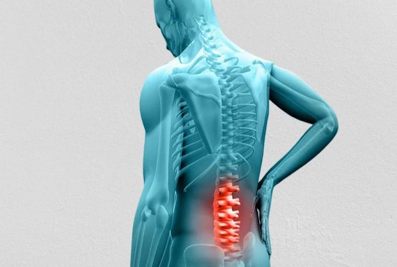 Degenerative Disc Disease