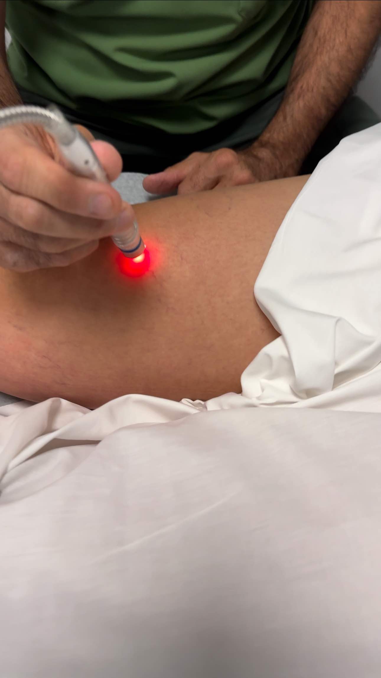 Varicose veins Laser Therapy