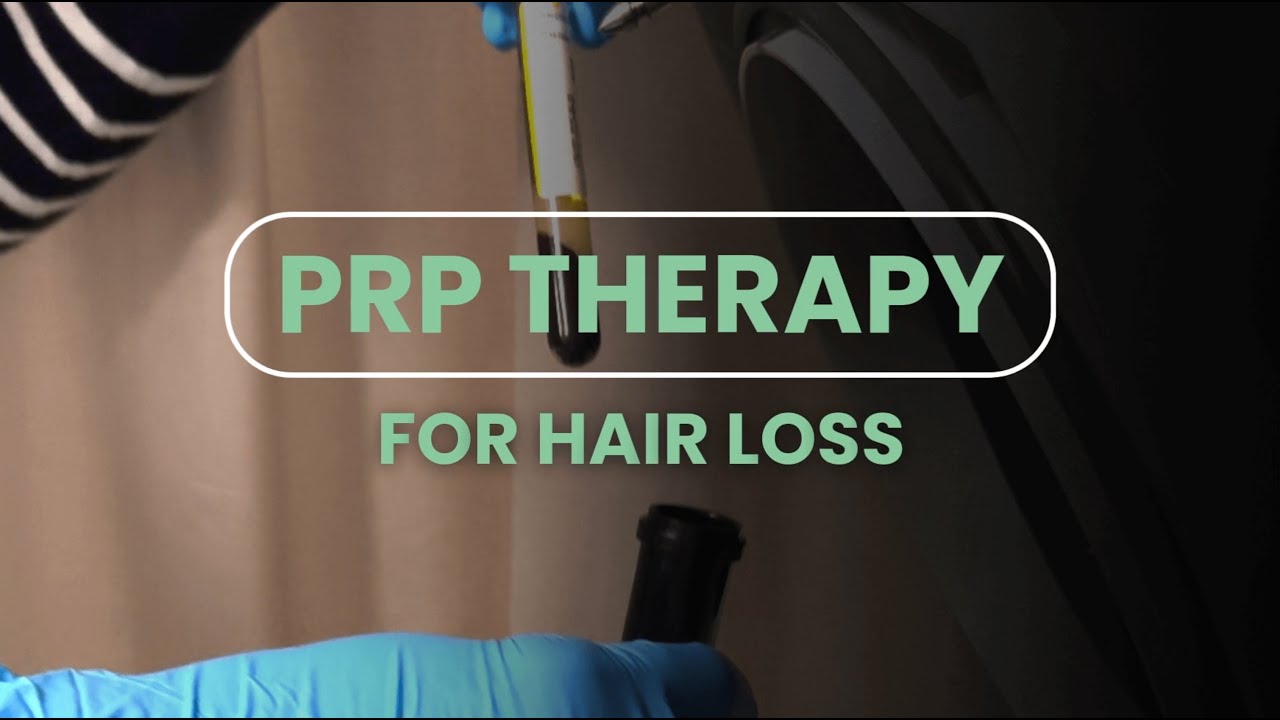 PRP for Hair Loss in Richmond Hill - York Rehab Clinic