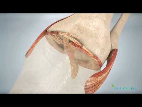 Knee Decompression and Physio Treatment - York Rehab Clinic